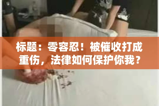 标题：零容忍！被催收打成重伤，法律如何保护你我？